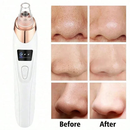 Electric Pore Cleaner & Blackhead Remover